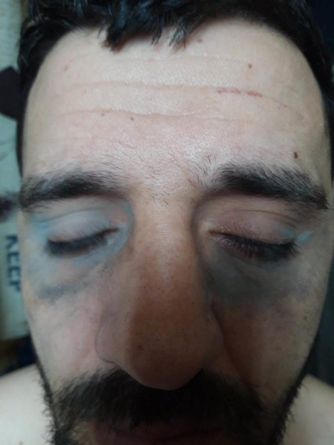 Βασανισμός κρατουμένου 