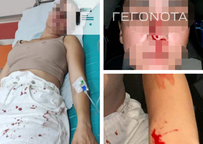 ΞΥΛΟΔΑΡΜΟΣ ΒΟΛΟΣ