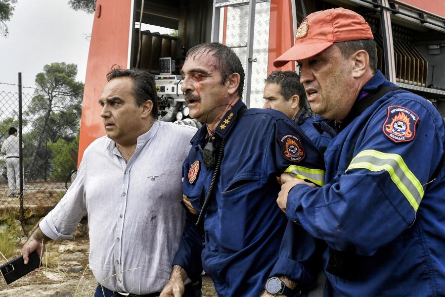 Ο πυροσβέστης που τραυματίστηκε στο Σοφικό