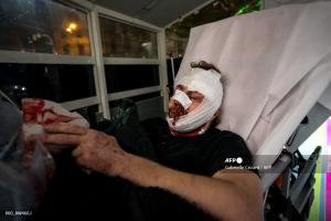 ΓΑΛΛΙΑ ΑΜΙΡ ΑΛ ΧΑΛΜΠΙ ΤΡΑΥΜΑΤΙΣΜΟΣ ΓΑΛΛΙΚΟ ΠΡΑΚΤΟΡΕΙΟ