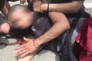 Τραυματισμένος φοιτητής από τα ΜΑΤ στο ΑΠΘ