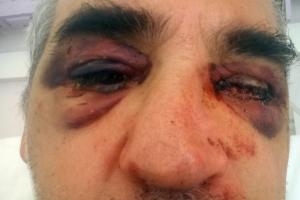 ΨΑΡΡΟΣ ΑΡΧΑΙΟΛΟΓΟΣ ΞΥΛΟΔΑΡΜΟΣ