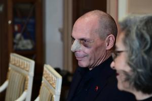 Ο Γιάνης Βαρουφάκης μετά από την επίθεση που δέχτηκε