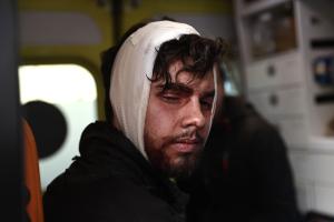 Τραυματισμένος φοιτητής