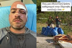 Επίθεση στην Πάρνηθα