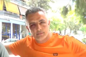 Ο ελεγκτής με μώλωπες στα μάτια μετά τον ξυλοδαρμό του