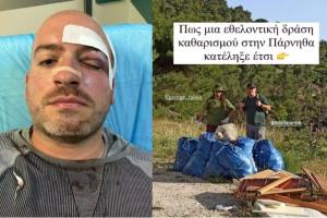ΕΘΕΛΟΝΤΕΣ ΠΑΡΝΗΘΑ