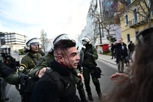 Τραυματίας με αίματα στο κεφάλι που τον κρατά ΜΑΤατζής