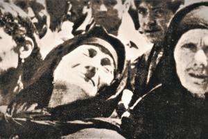 135697835-DISTOMO.jpg