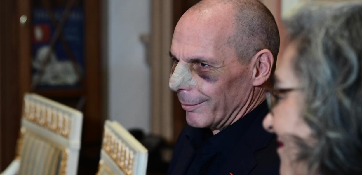 Ο Γιάνης Βαρουφάκης μετά από την επίθεση που δέχτηκε