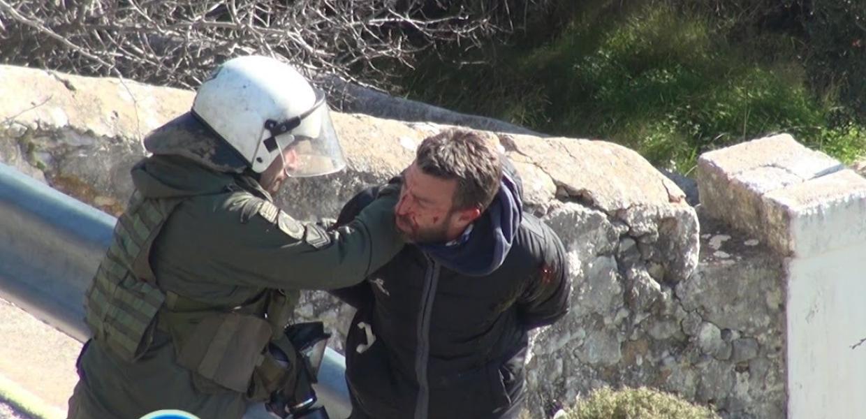 Ο ΜΑΤατζής ξυλοκοπά πολίτη