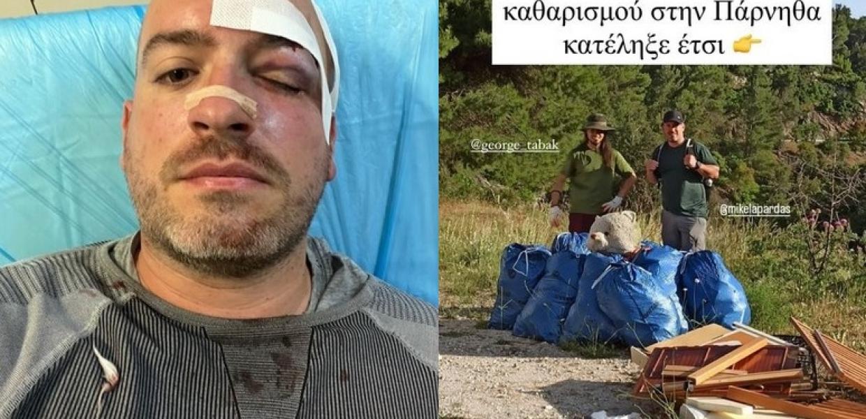 Επίθεση στην Πάρνηθα