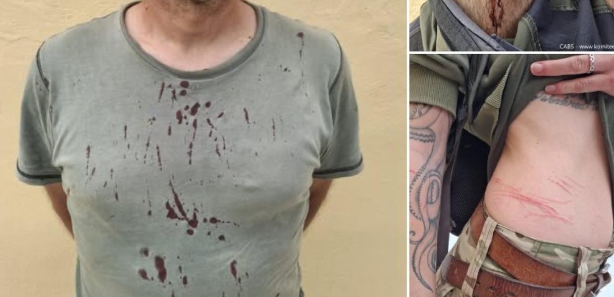 Τραυματισμένοι εθελοντές από λαθροθήρες